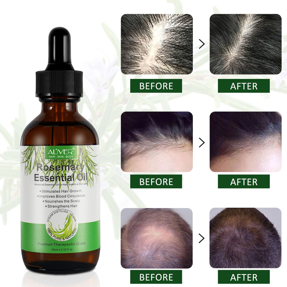 NIFEISHI huile romarin soin sourcils et cils pour un regard net.