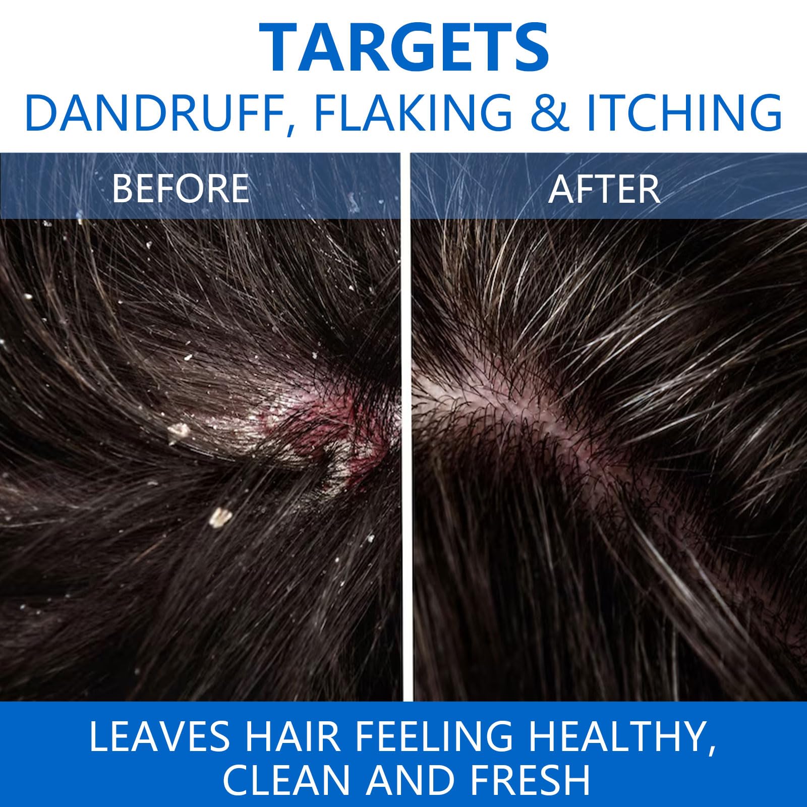 Shampoing NIPPORI apaisement-cuir-chevelu, soulage les irritations et procure une sensation de fraîcheur.