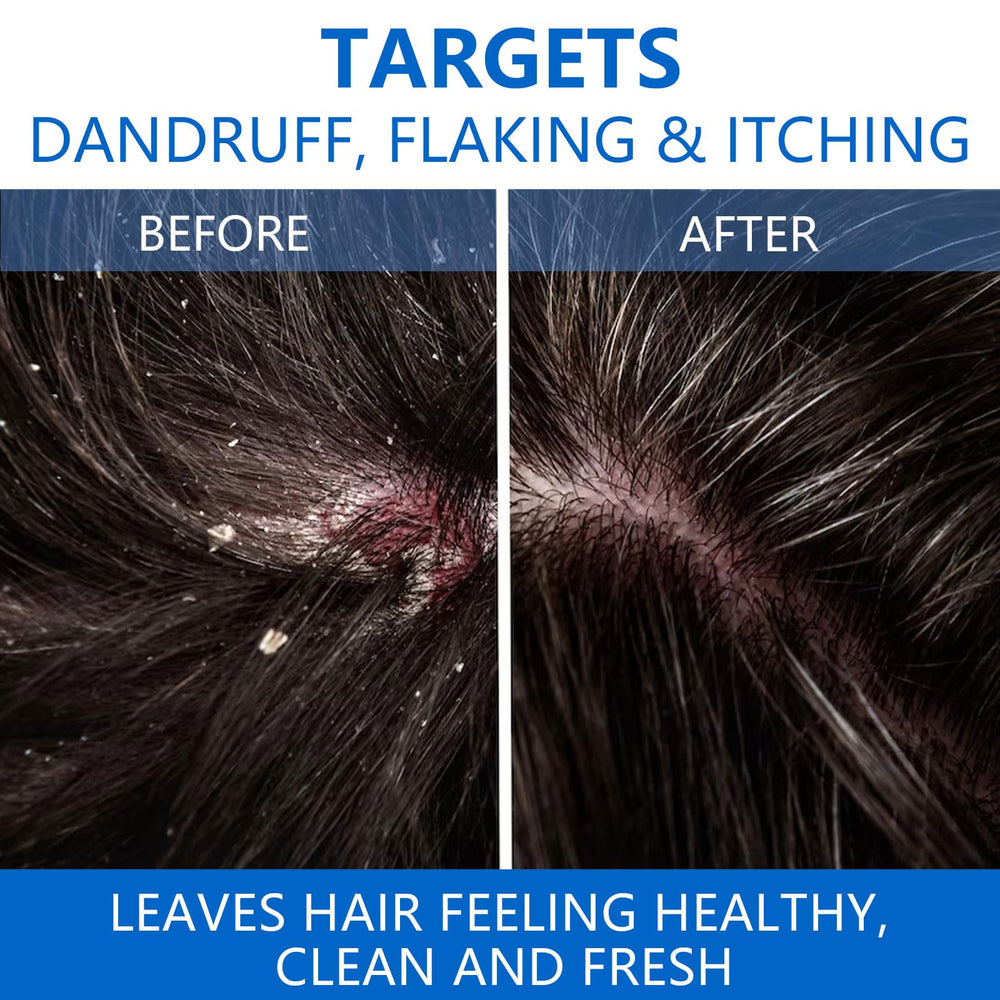 Shampoing NIPPORI apaisement-cuir-chevelu, soulage les irritations et procure une sensation de fraîcheur.