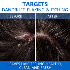 Shampoing NIPPORI apaisement-cuir-chevelu, soulage les irritations et procure une sensation de fraîcheur.