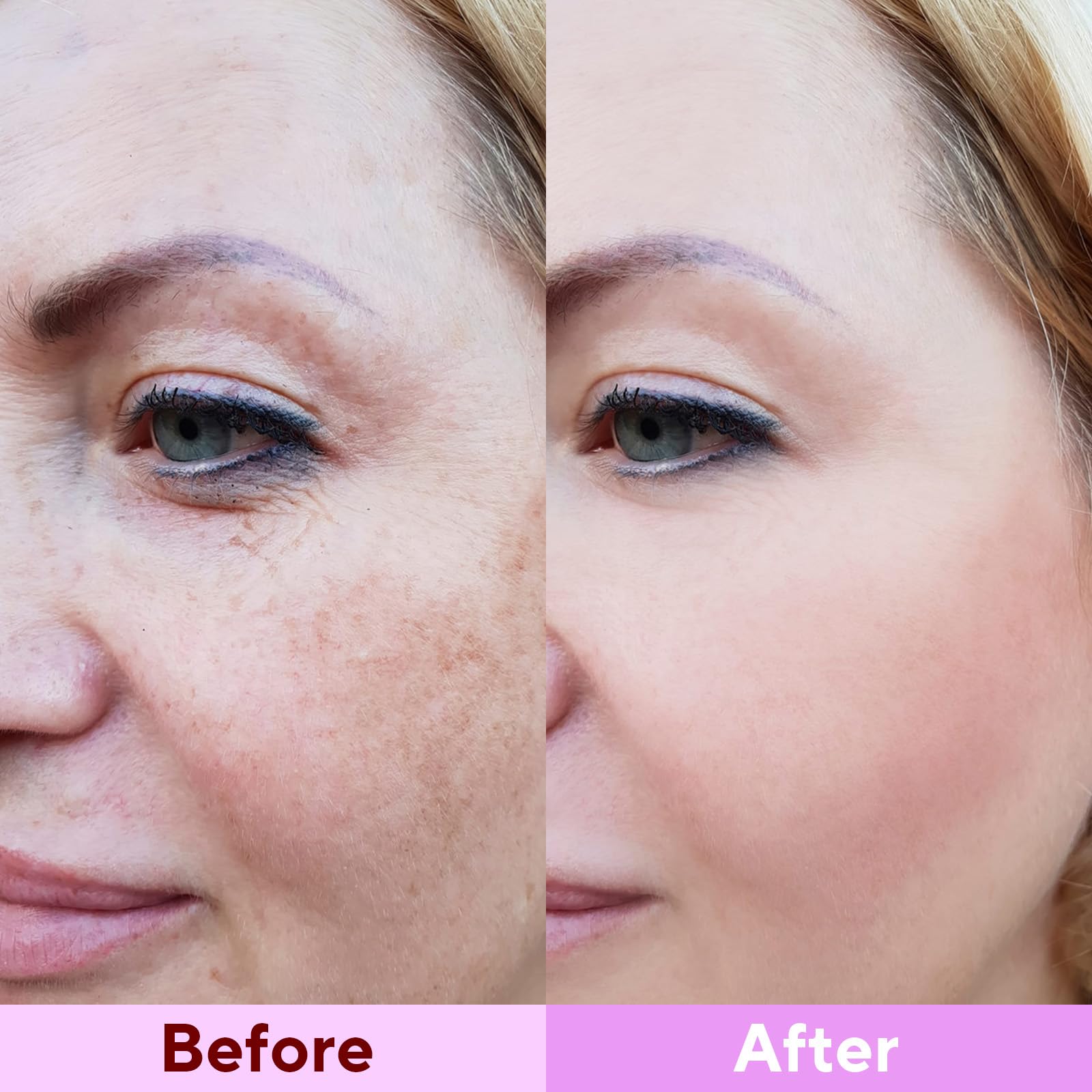 Avant/après réels avec le masque Bio-Collagène Nityrliv