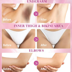 Nivexis Zone aisselles-bikini — soin pour zones sensibles.