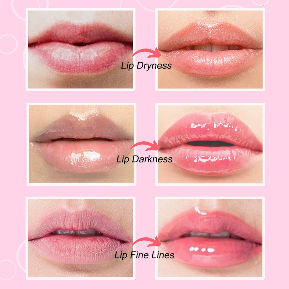 Hydratation en profondeur avec NIYET Masque Lèvres Crystal au collagène