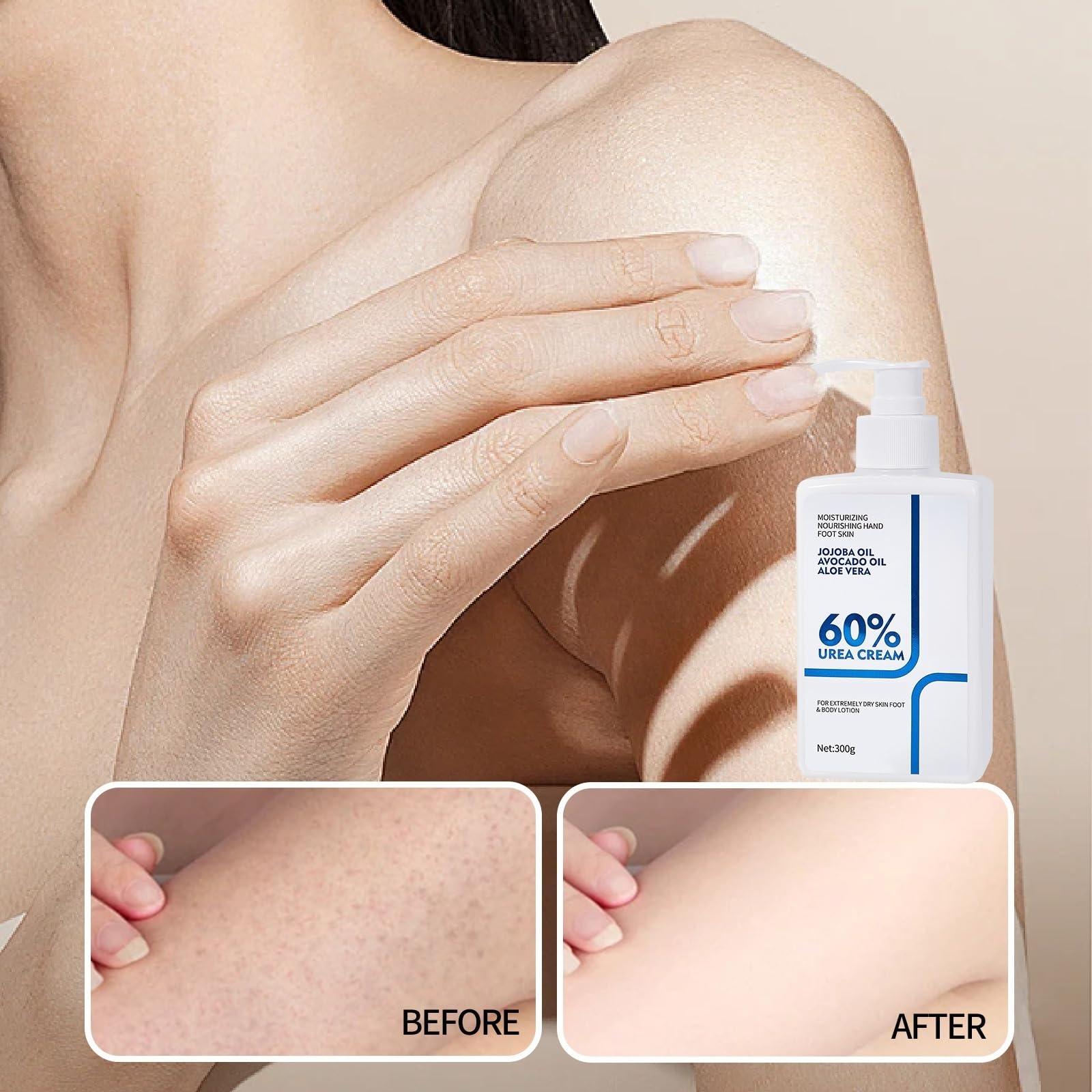 Coffret cadeau NIZENTA crème urée 60% pour soins quotidiens.