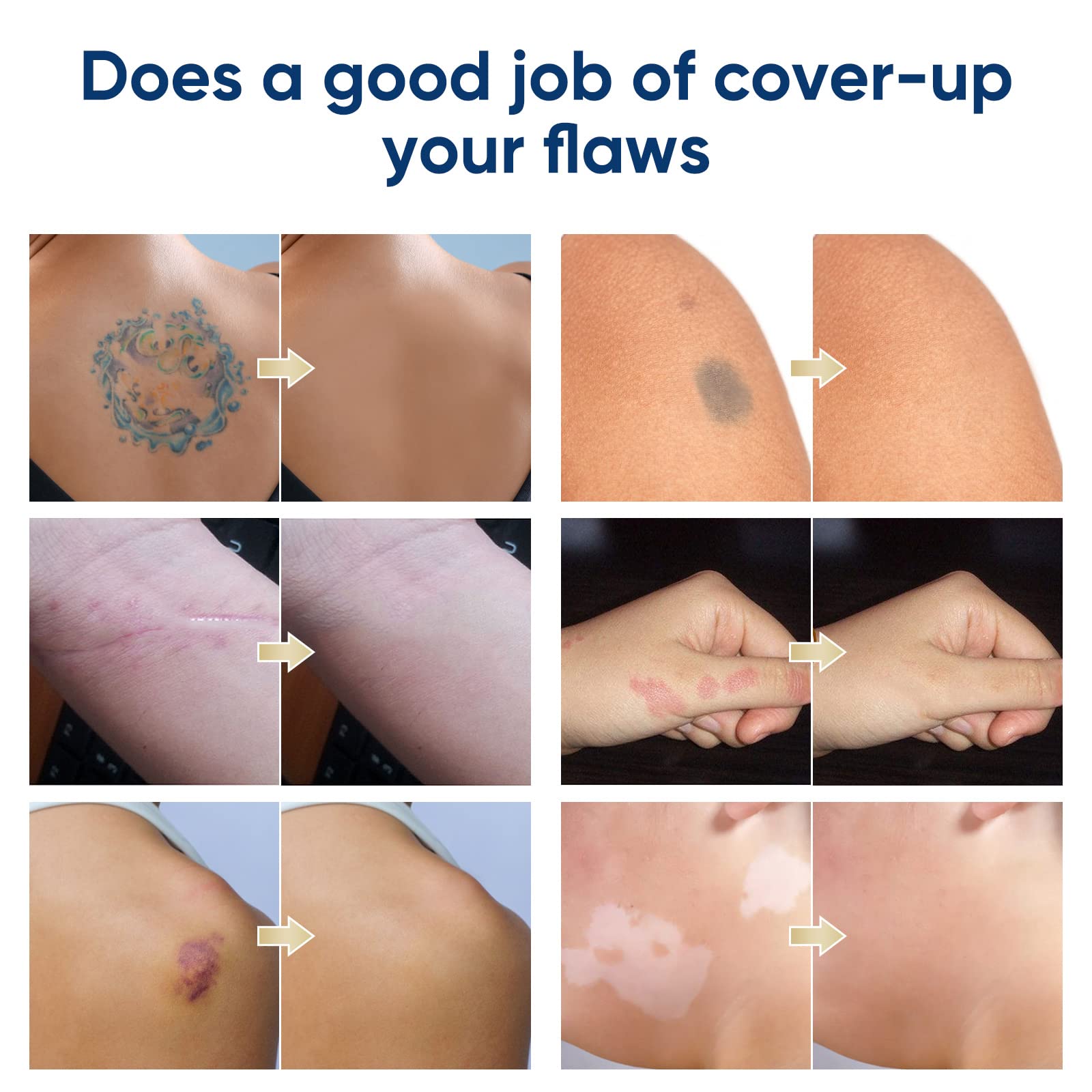 NOBA couverture tatouage étanche – teinte foncée adaptée à une carnation moyenne.
