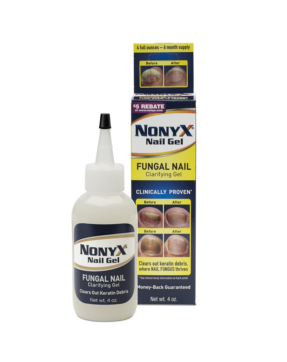 Nonyx Gel pour ongles clarifie l’apparence et élimine les débris sous l’ongle