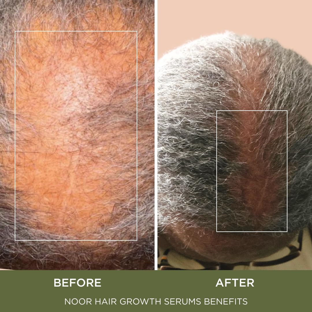 NOOR HAIR ingrédients-cles: cannelle, biotine et ginkgo pour nourrir les follicules.