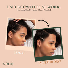 NOOR HAIR sérum, massage des racines pour une base capillaire saine.