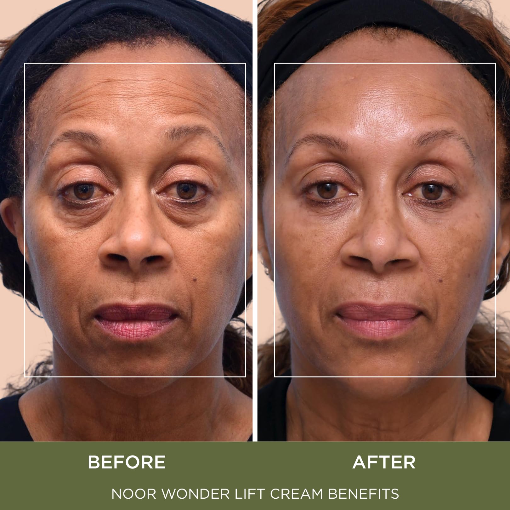 NOOR HAIR Wonder Lift Crème – application rapide matin et soir