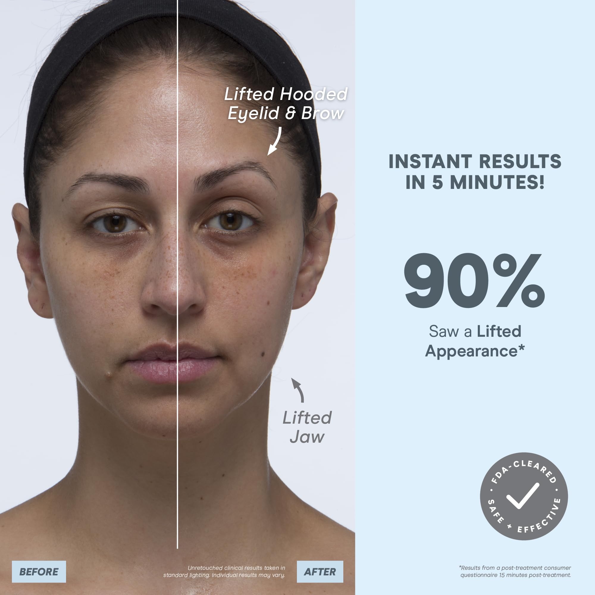 NuFACE MINI+ contour du visage et du cou peut paraître plus net après utilisation régulière.