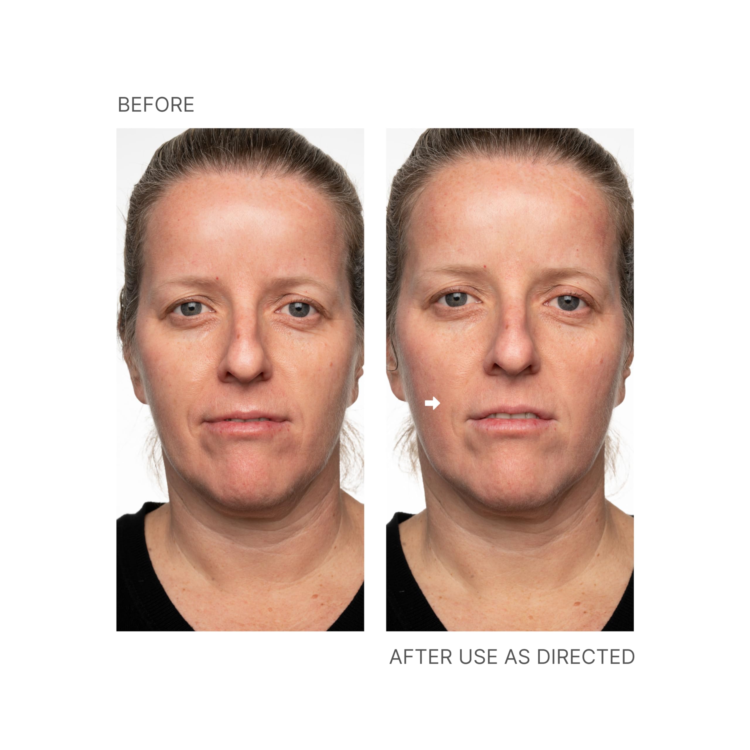 Nu Skin Face Lift avec Activateur, effet immédiat sur le visage après utilisation.