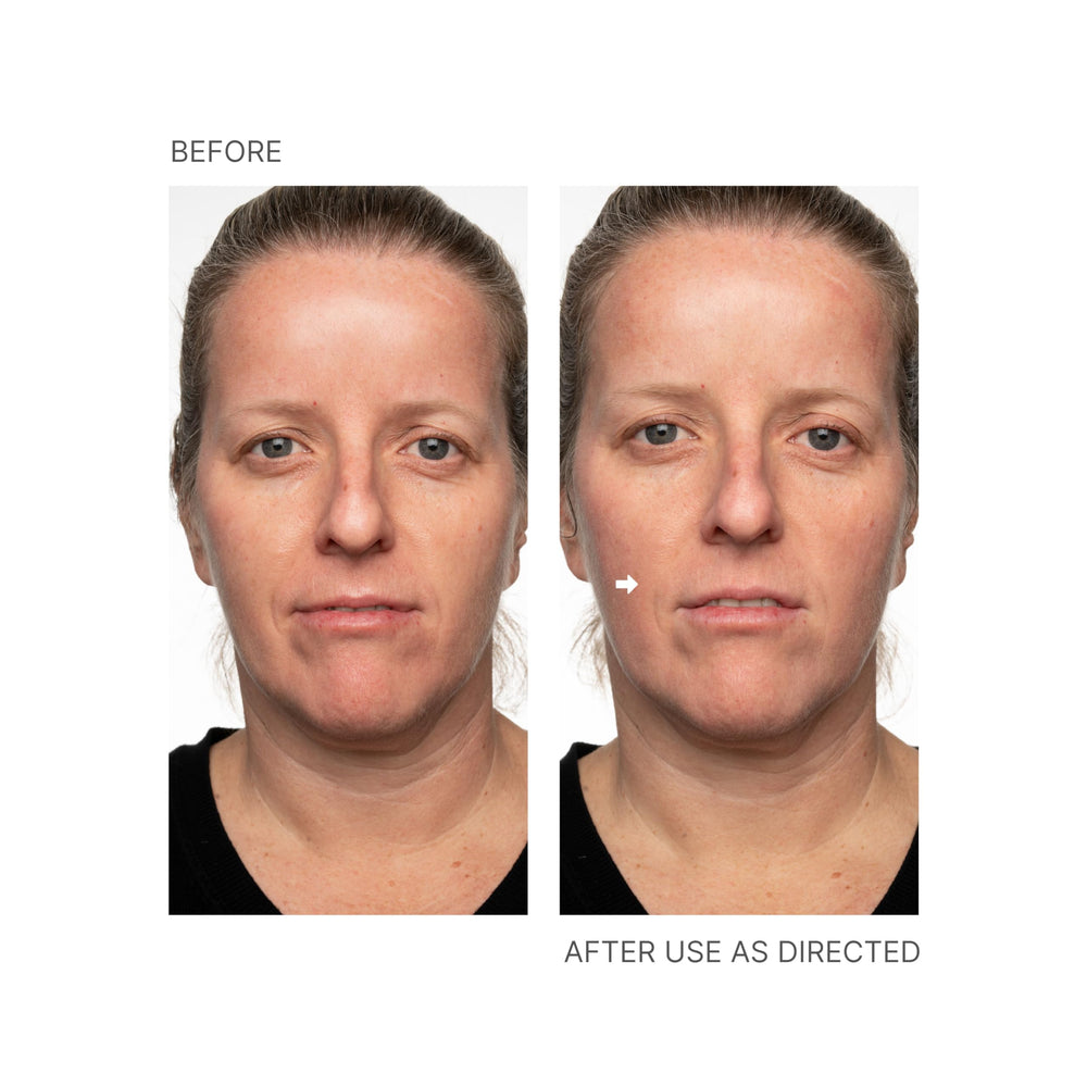 Nu Skin Face Lift avec Activateur, effet immédiat sur le visage après utilisation.