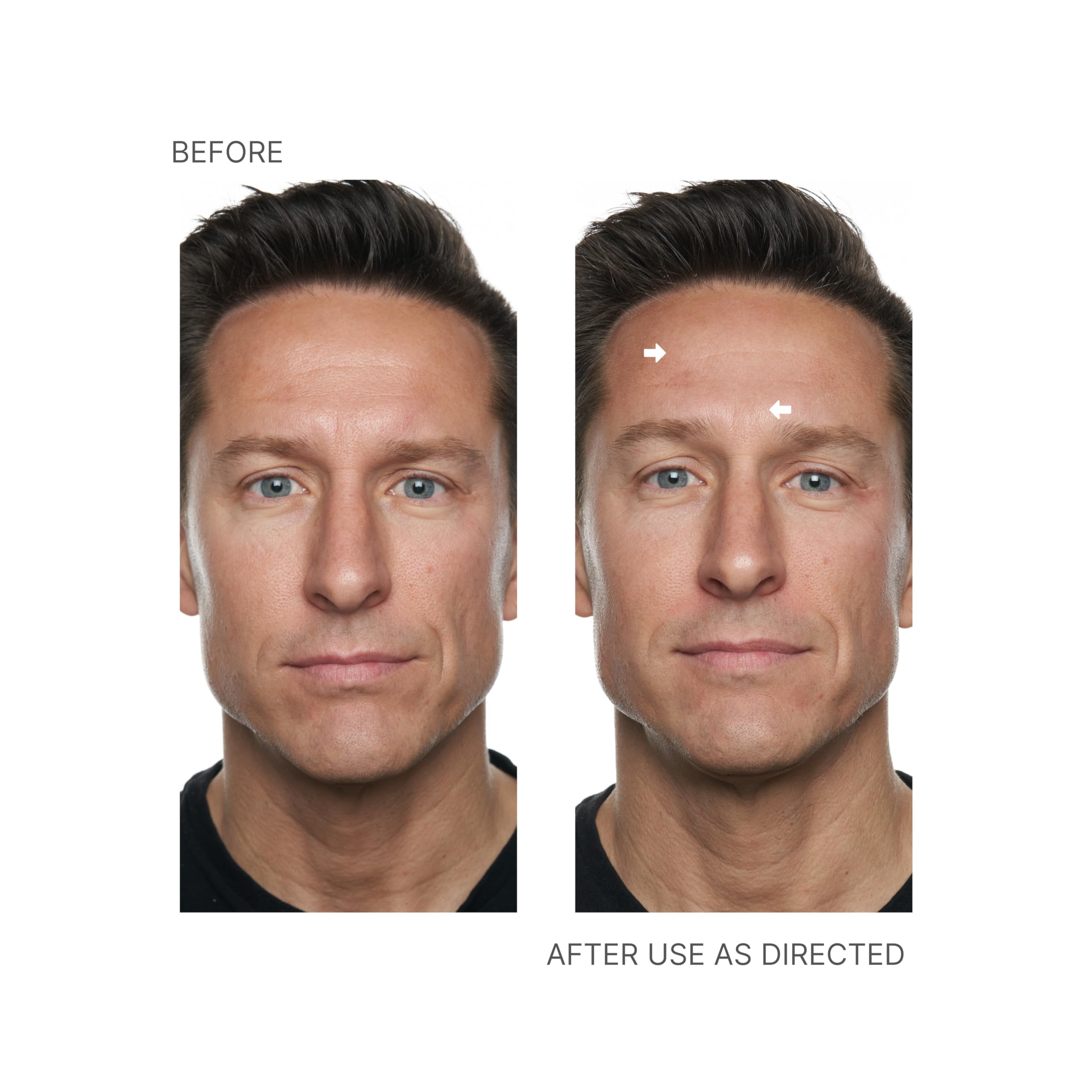 Nu Skin Face Lift avec Activateur, sans parfum, soin adapté peaux sensibles.
