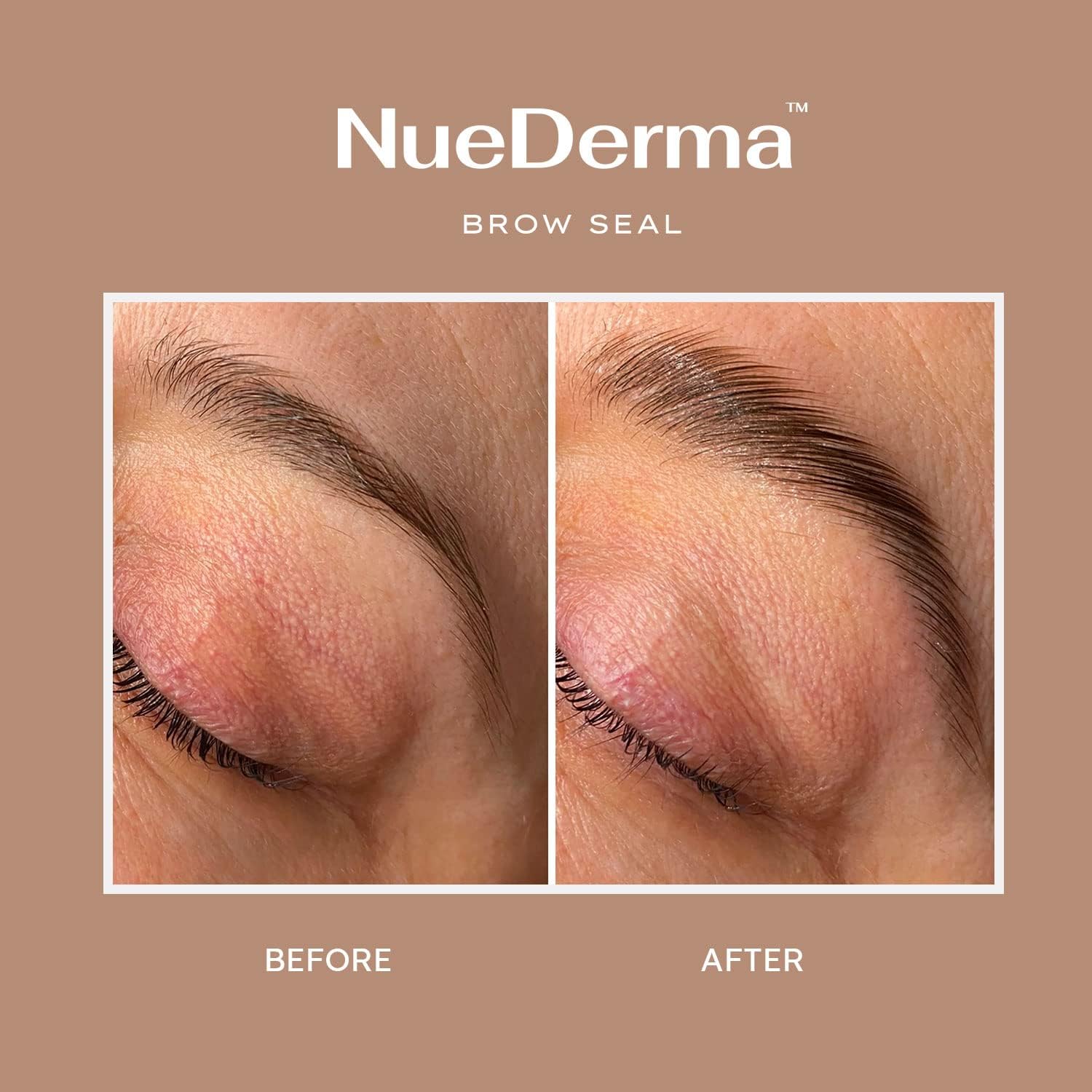 Fixation longue durée sans résidu avec le gel NueDerma.