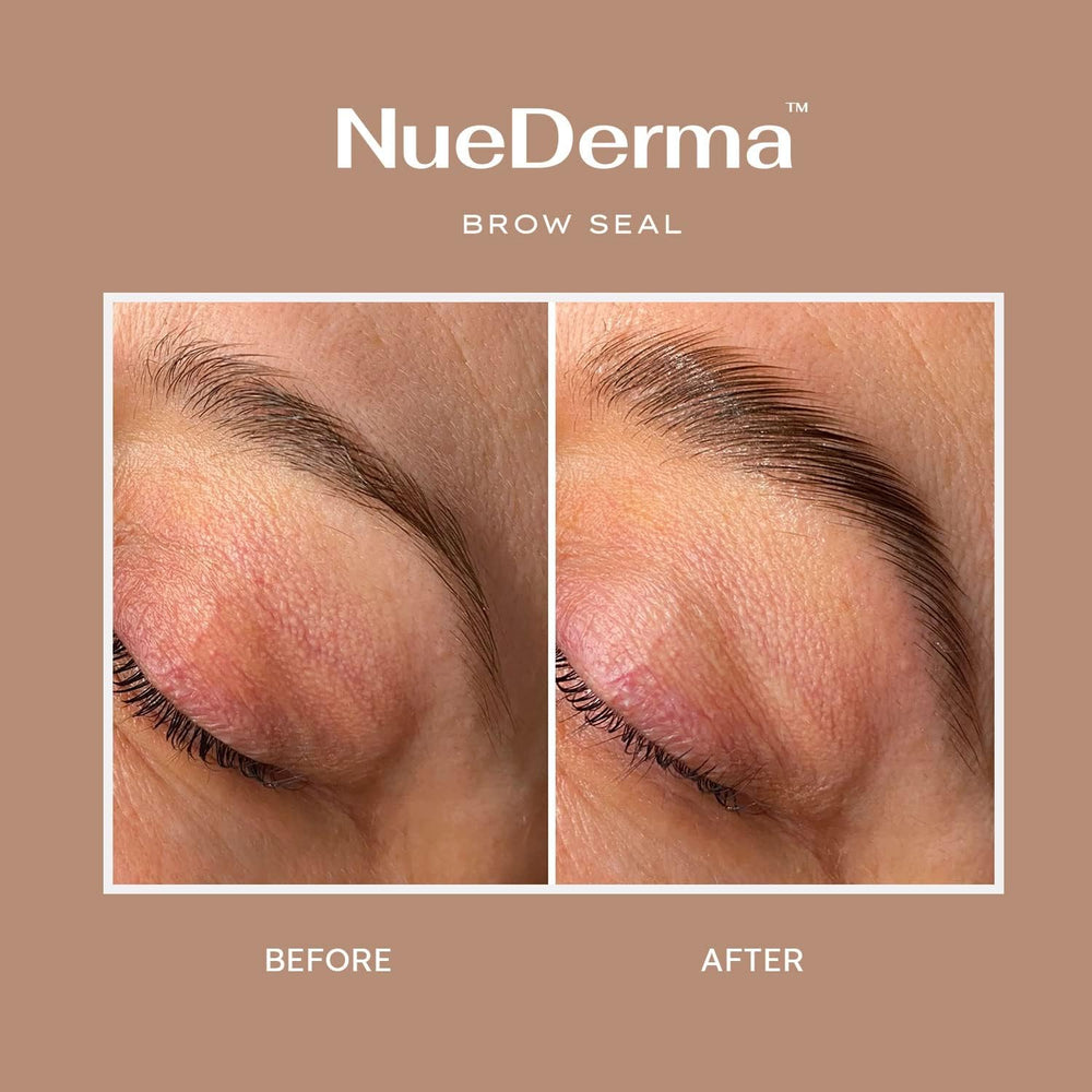 Fixation longue durée sans résidu avec le gel NueDerma.