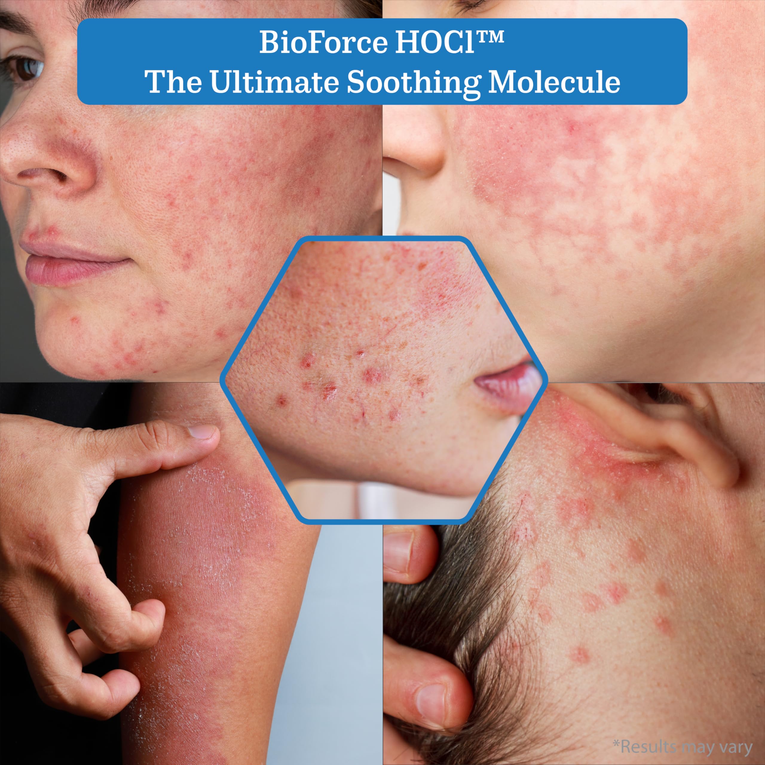 NueVue HOCl apres-perçage remplissage 33oz