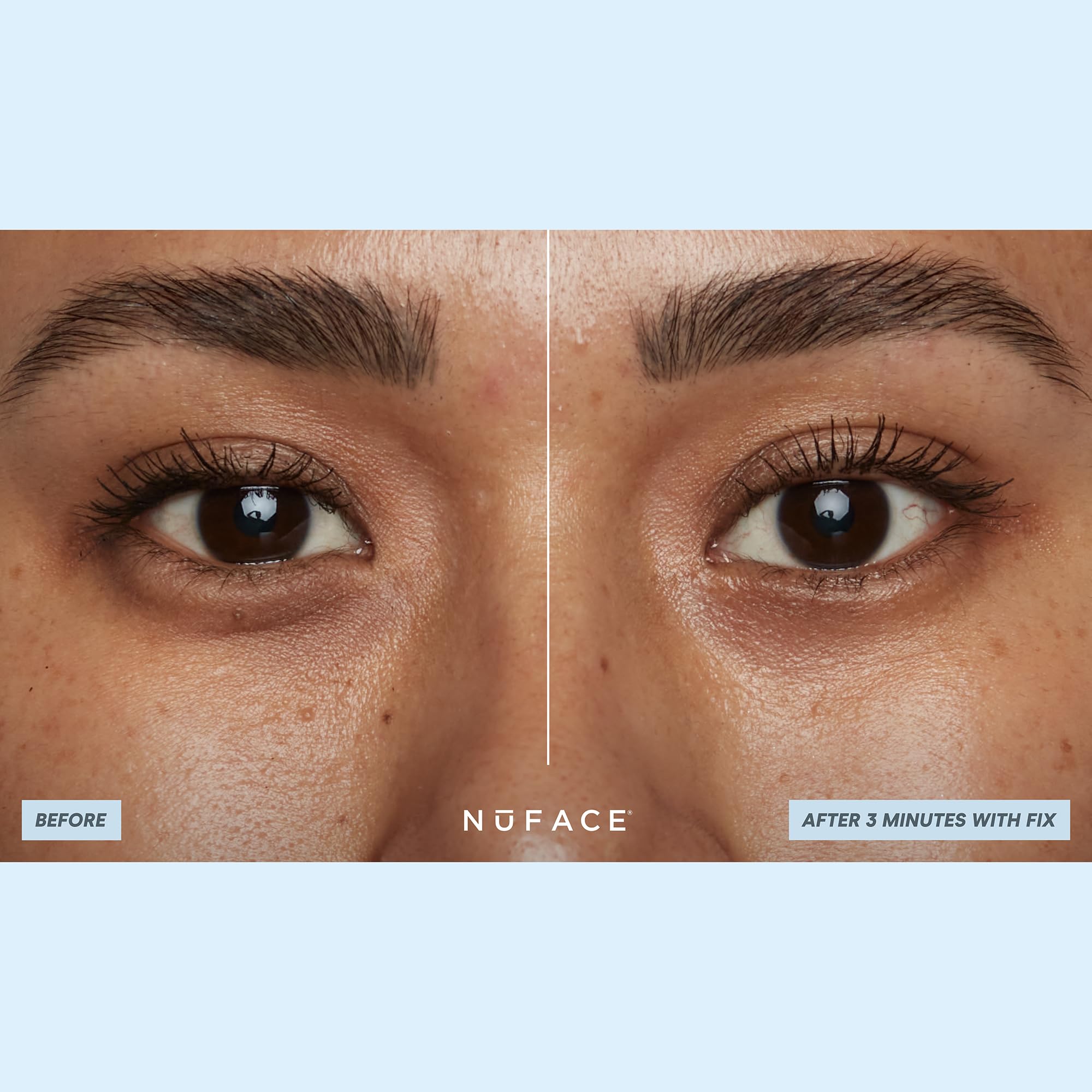 NuFACE IonPlex Hydra-Gel Patchs forme ergonomique qui épouse les contours