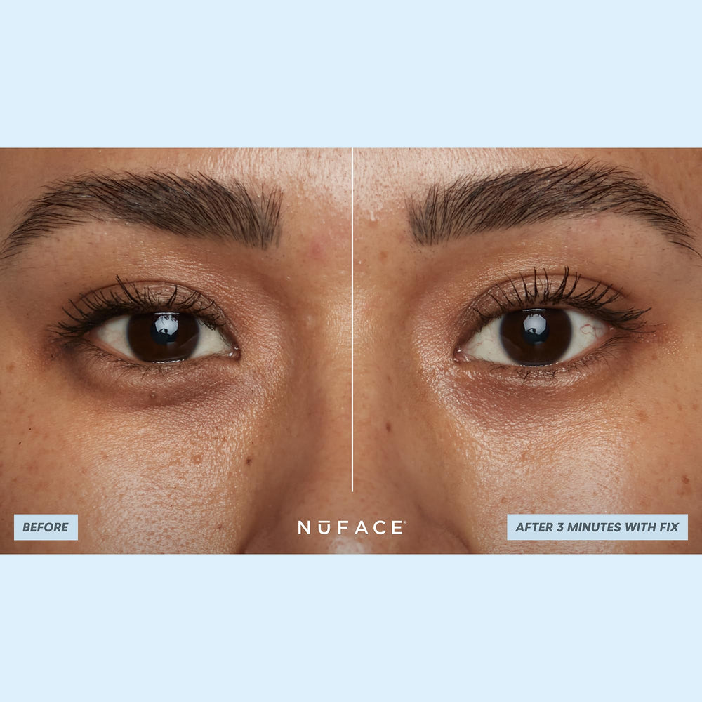 NuFACE IonPlex Hydra-Gel Patchs forme ergonomique qui épouse les contours