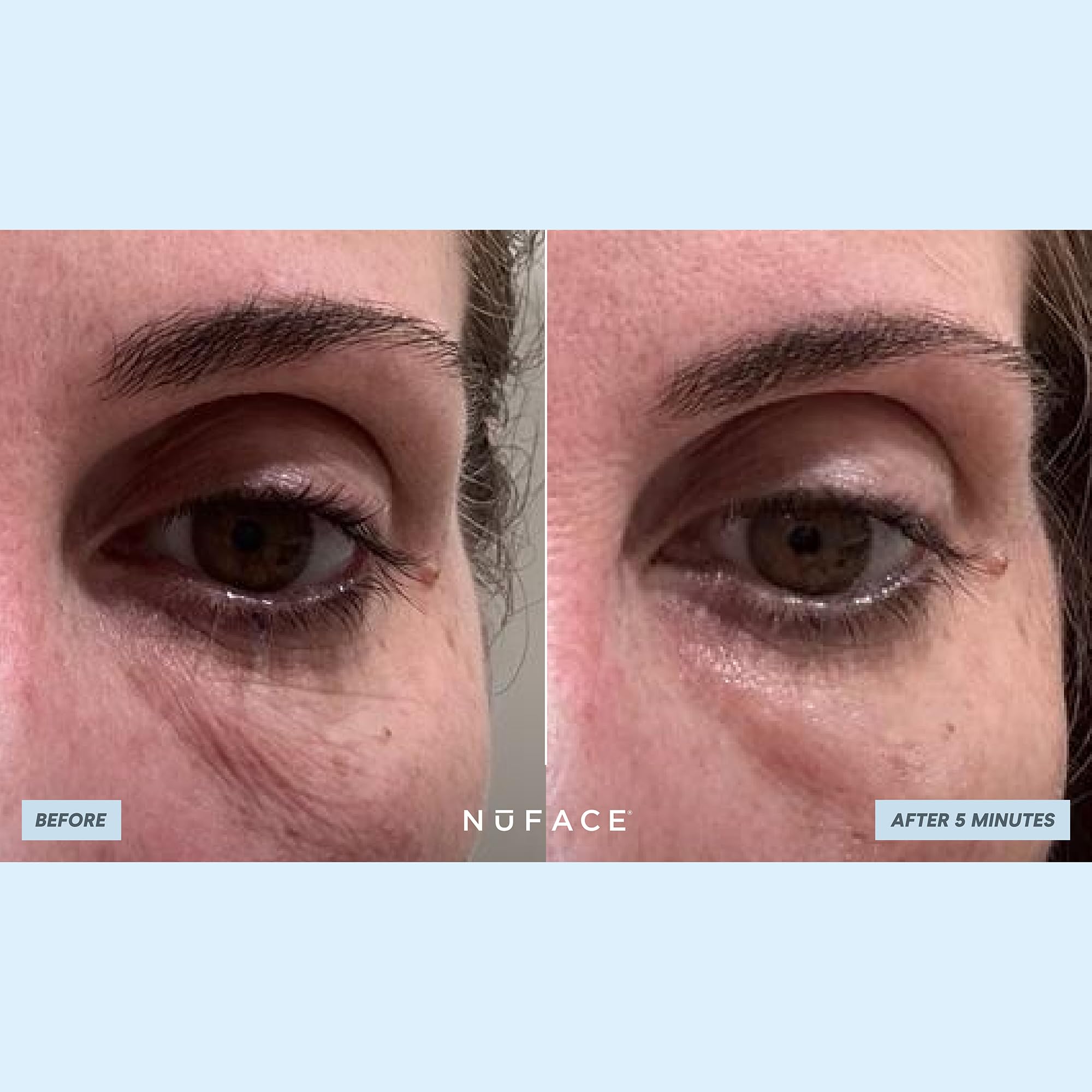 NuFACE IonPlex Hydra-Gel Patchs avec ingrédients IonPlex pour hydratation