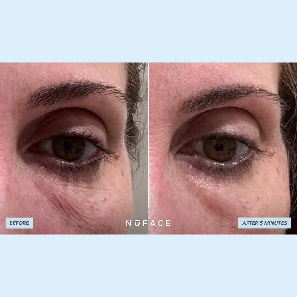 NuFACE IonPlex Hydra-Gel Patchs avec ingrédients IonPlex pour hydratation