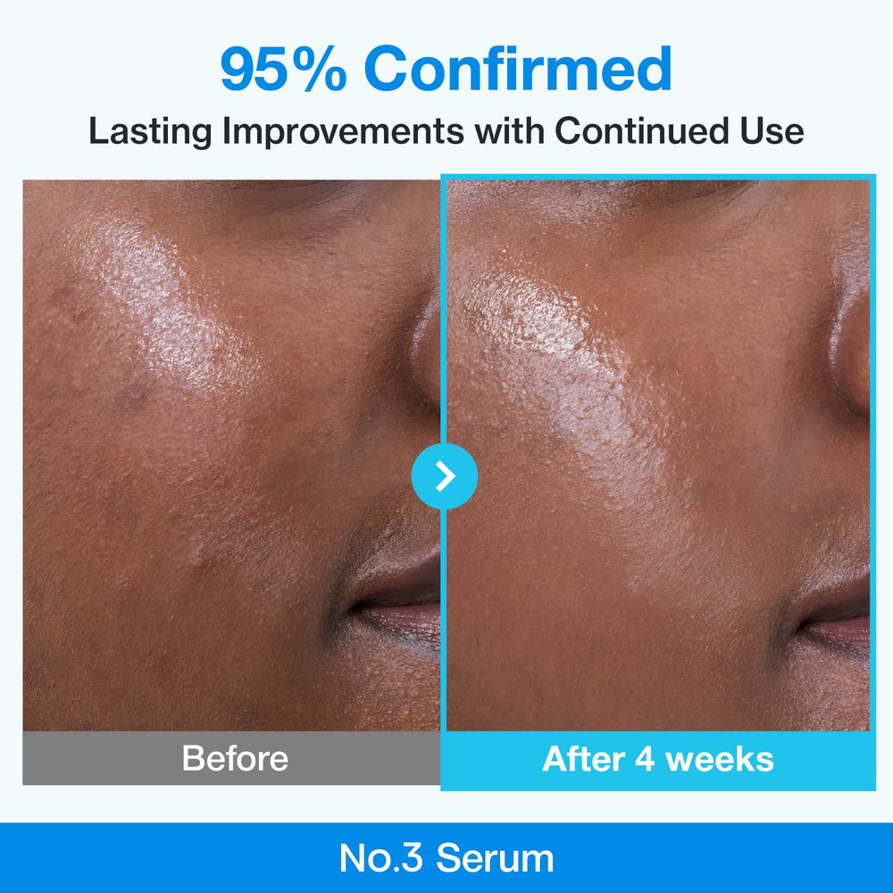 Sérum numbuzin No.3 avec Niacinamide 10% pour une peau uniforme.
