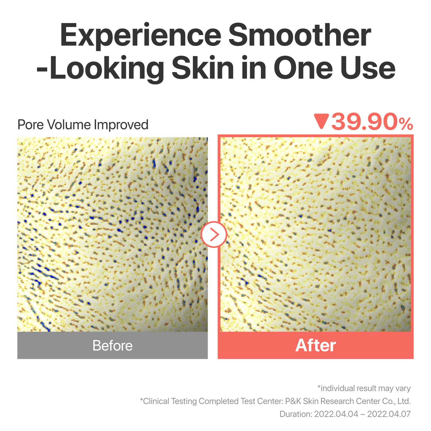 numbuzin No.3 Sheet Mask being applied for pore-softening skincare moment