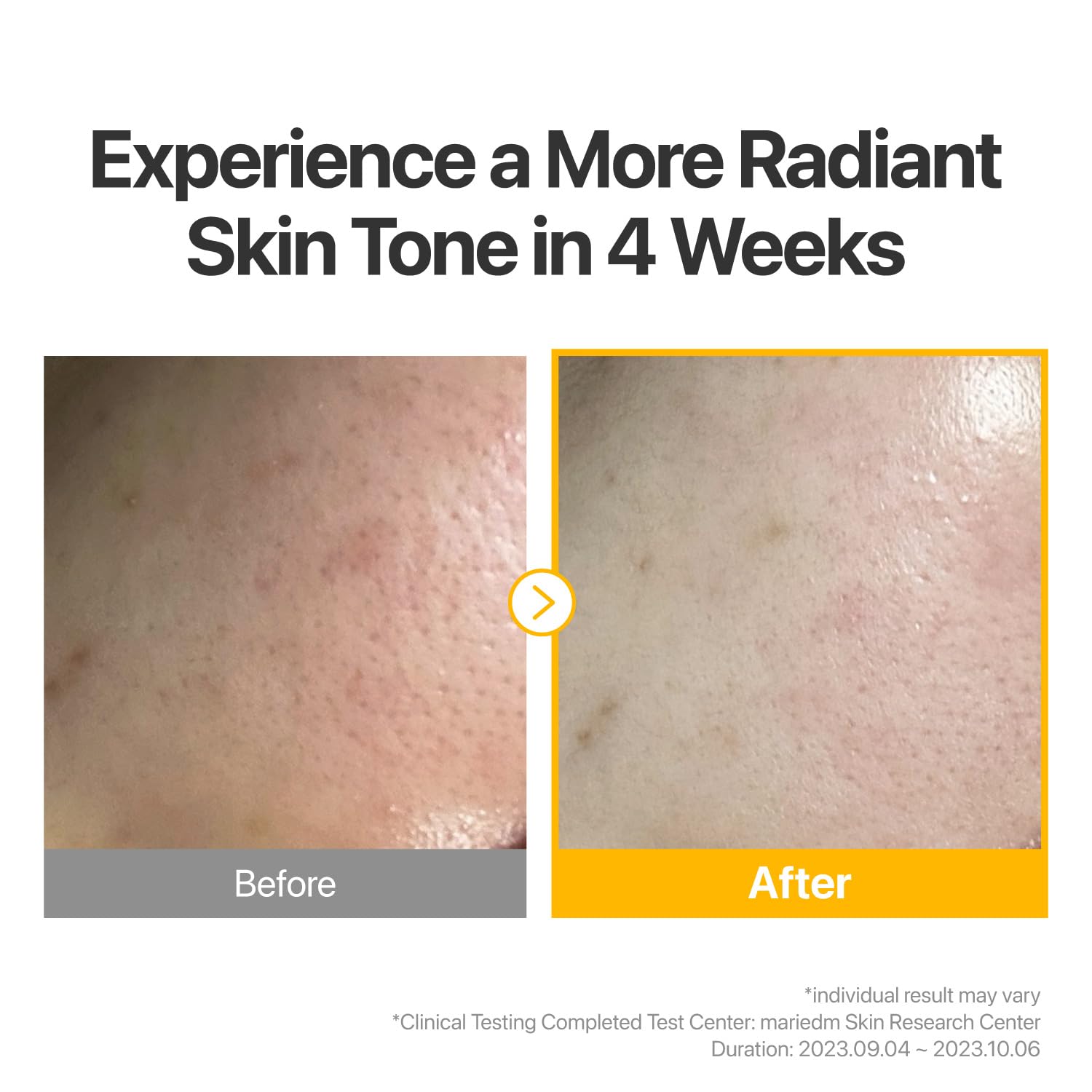 Masque anti-oxydants No.5: glutathion et vitamine C favorisant l’uniformité