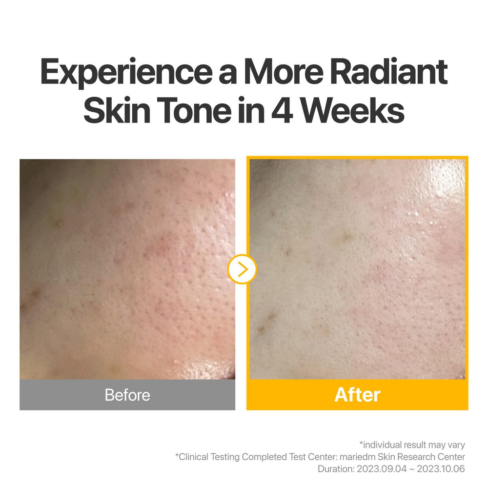 Masque anti-oxydants No.5: glutathion et vitamine C favorisant l’uniformité