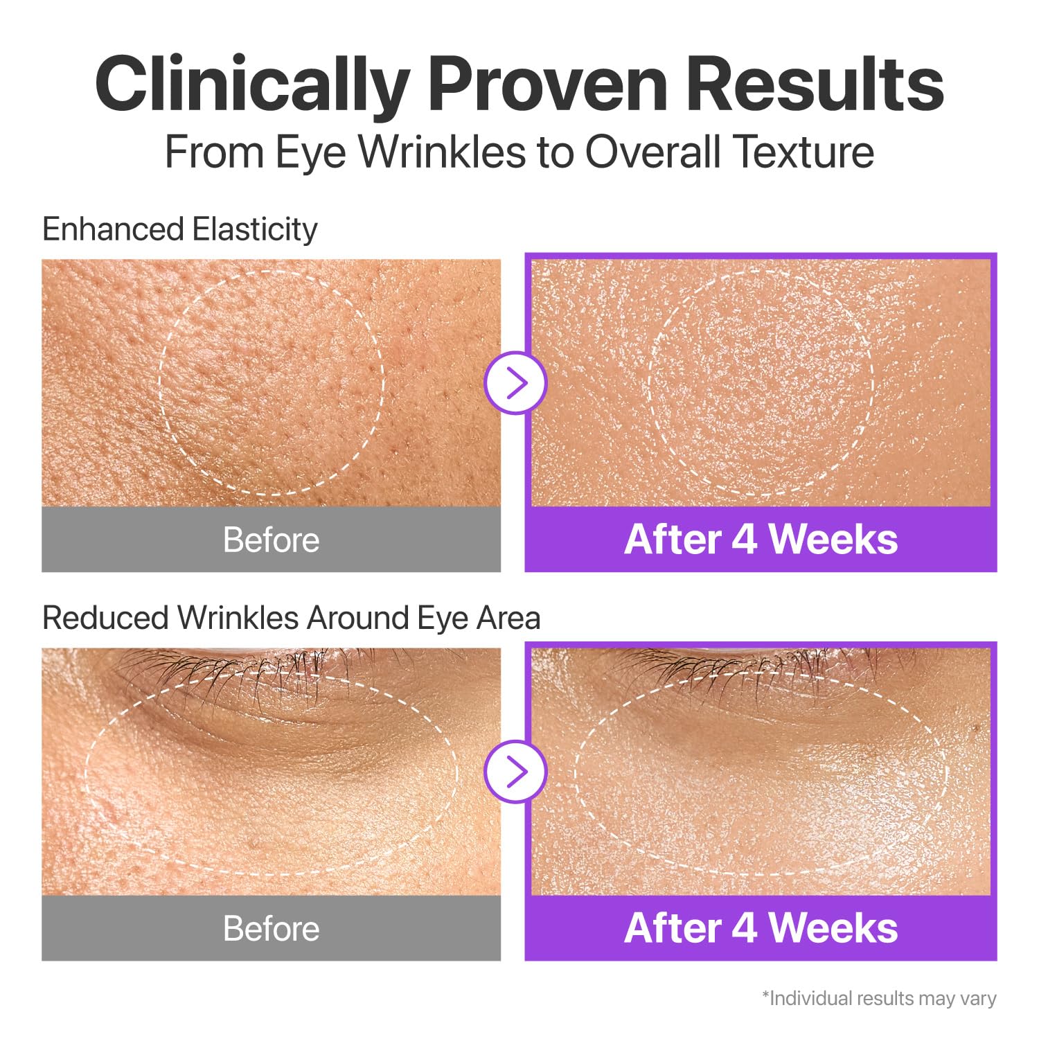 Élasticité améliorée avec Numbuzin No9 Serum pour une fermeté visible.