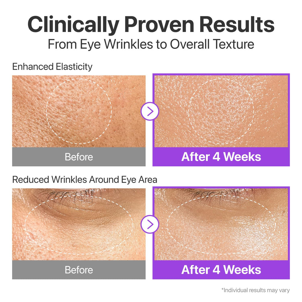 Élasticité améliorée avec Numbuzin No9 Serum pour une fermeté visible.