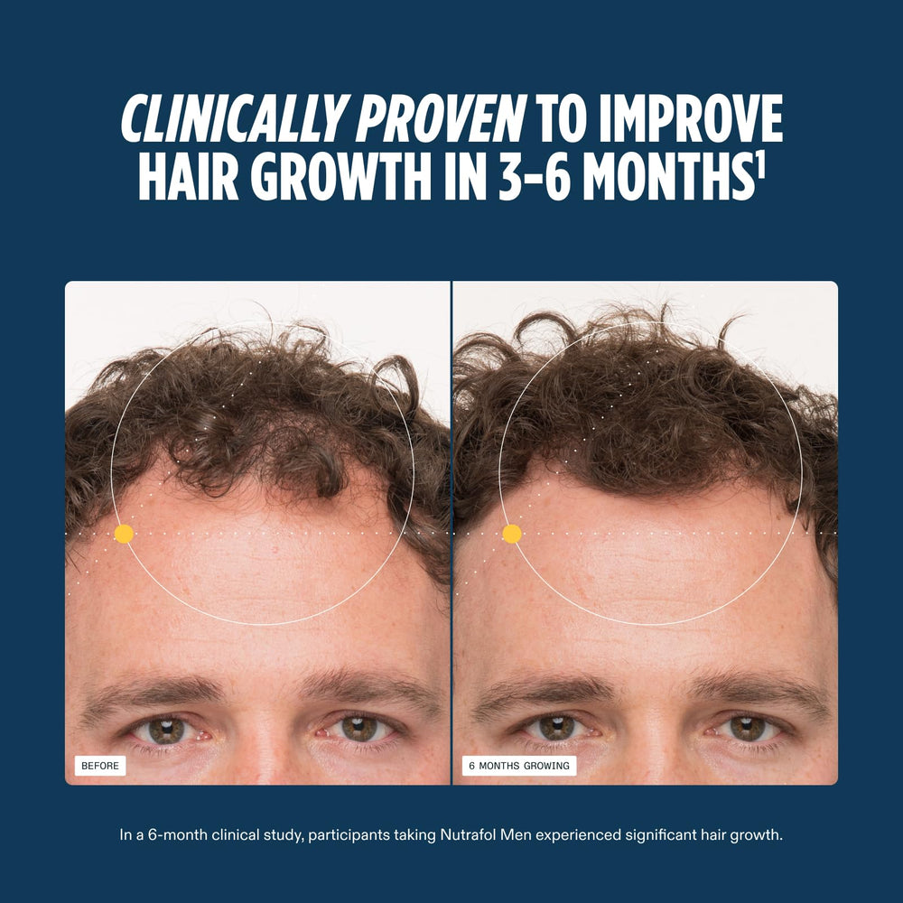 Nutrafol Men: Ingrédients-21-vitamines-minéraux, base scientifique pour cheveux