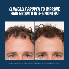 Nutrafol Men: Ingrédients-21-vitamines-minéraux, base scientifique pour cheveux