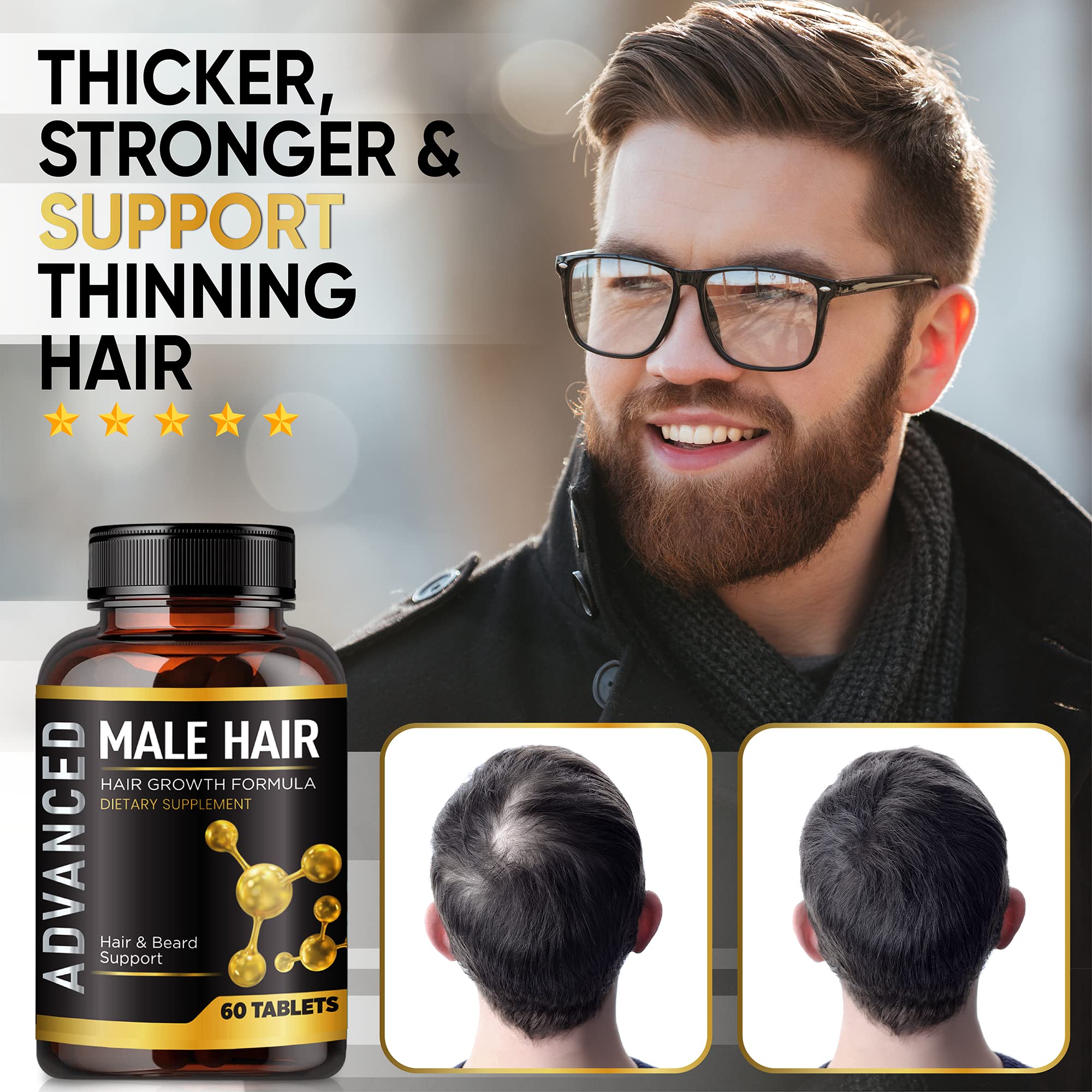 NutraPro Gelules capillaires pour cheveux plus forts chez l'homme.