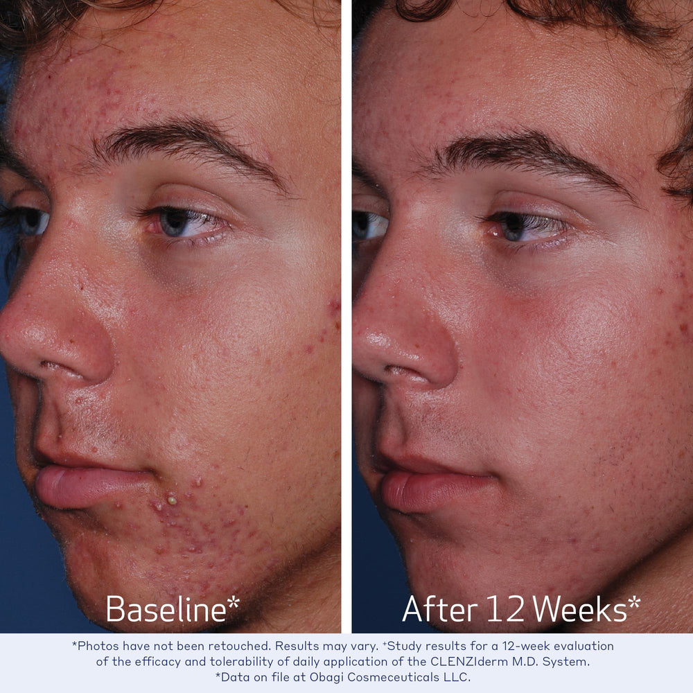 Obagi Clenziderm dermatologiquement testé: sécurité et efficacité perçues par les professionnels