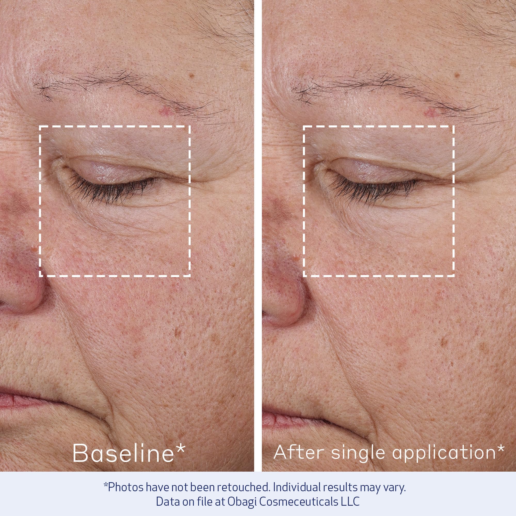 Obagi ELASTIderm Concentré Avancé – application matin et soir pour une peau plus tonique.