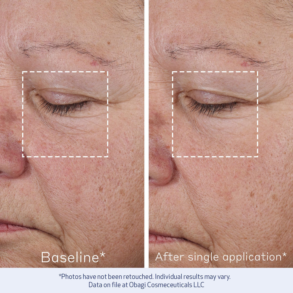 Obagi ELASTIderm Concentré Avancé – application matin et soir pour une peau plus tonique.