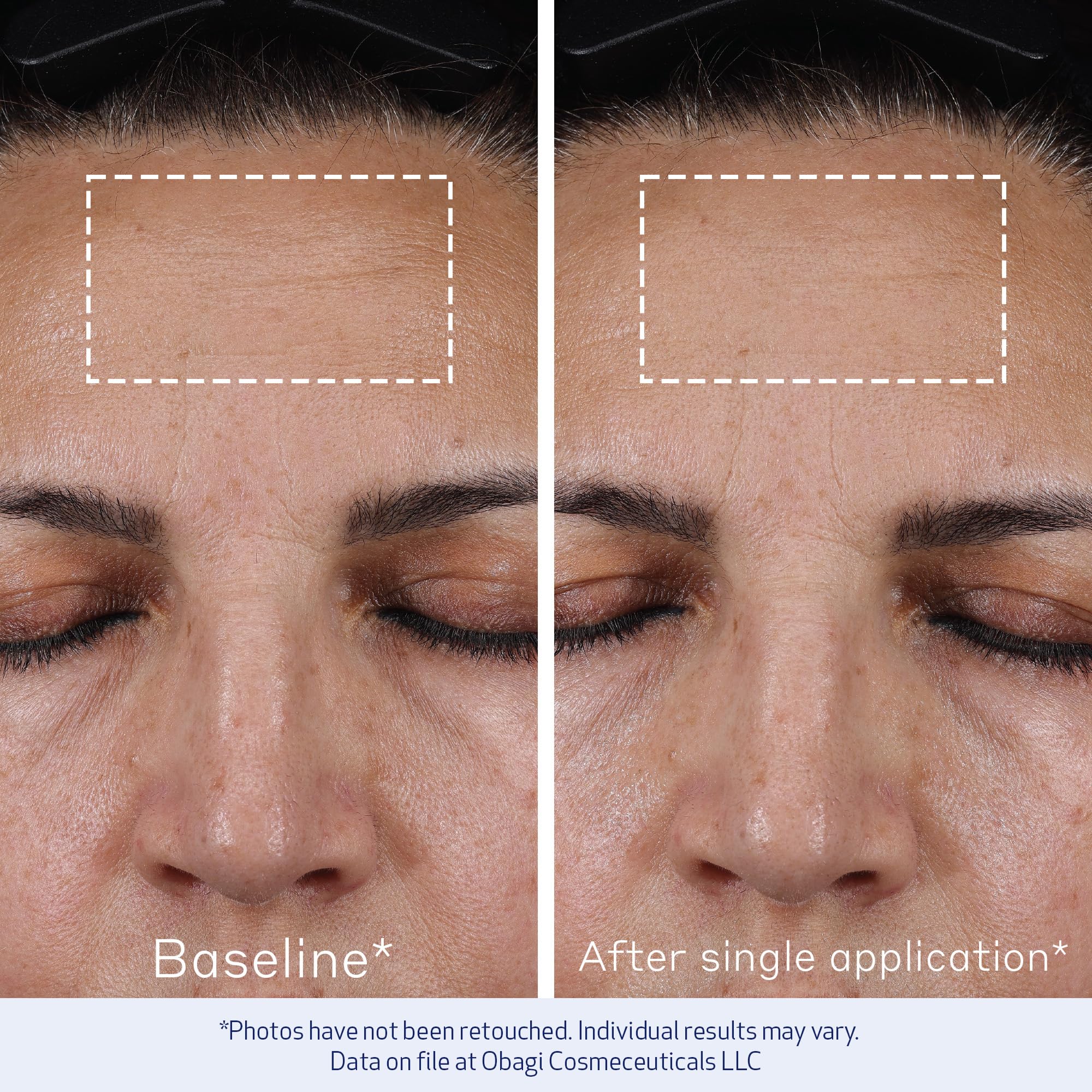 Obagi ELASTIderm Concentré Avancé – technologie peptide pour un effet repulpant potentiel.