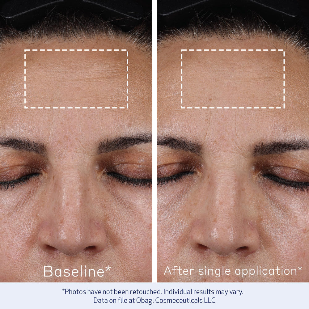 Obagi ELASTIderm Concentré Avancé – technologie peptide pour un effet repulpant potentiel.