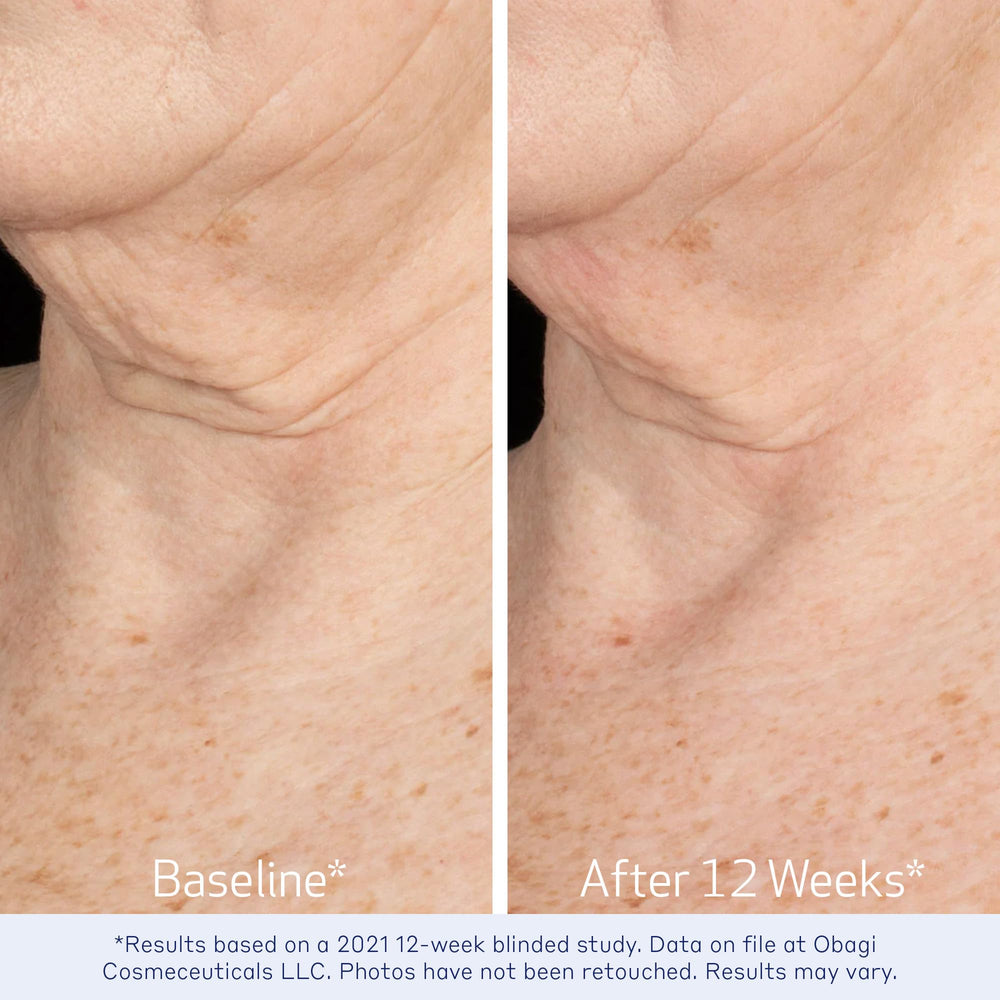 Obagi ELASTIderm Cou Décolleté Avant Après — démonstration d'améliorations potentielles.