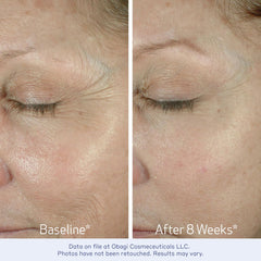 Regard frais et renouvelé avec Obagi ELASTIderm Crème Yeux.