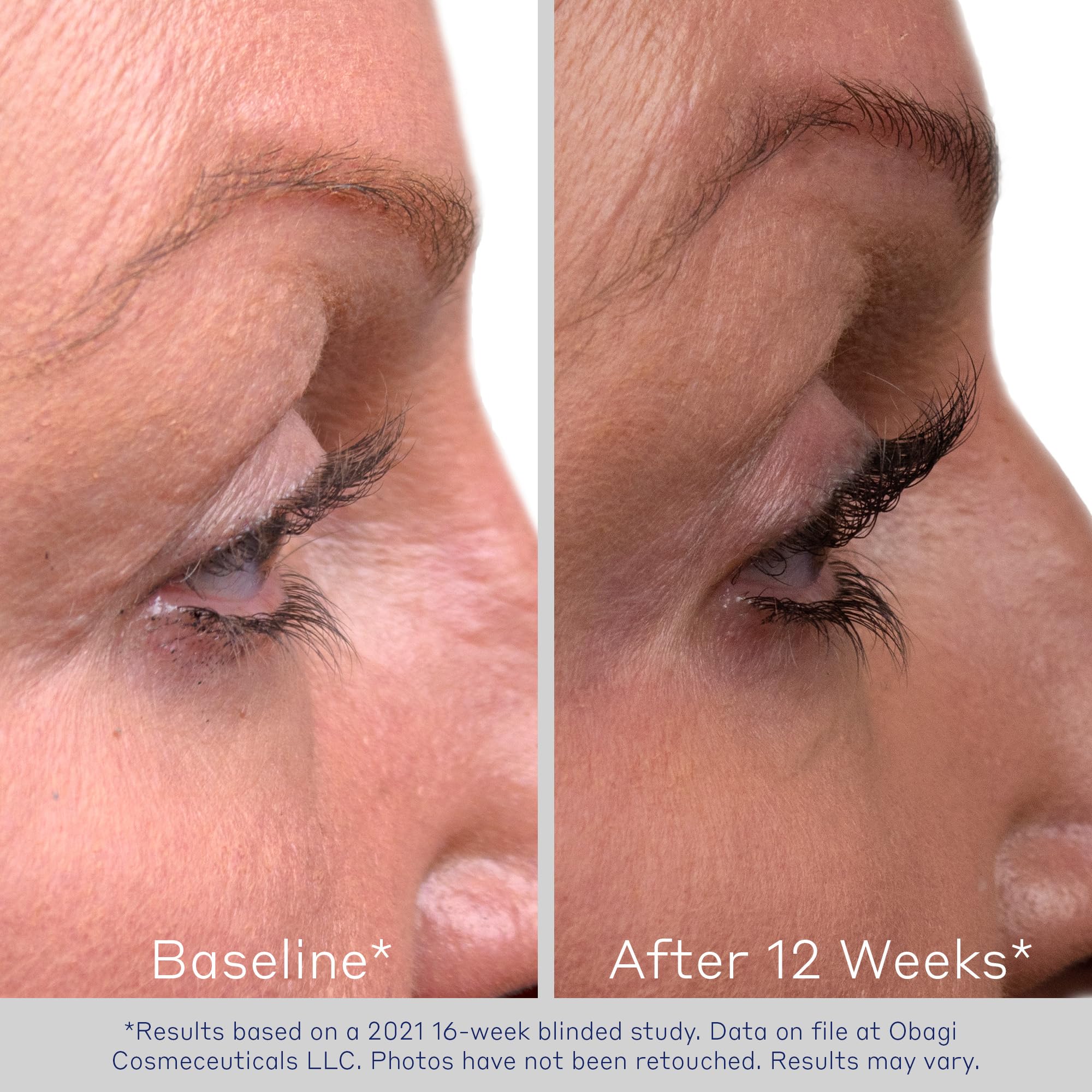 Obagi Nu-Cil – Formule biotine et hyaluronate pour fortifier les cils.