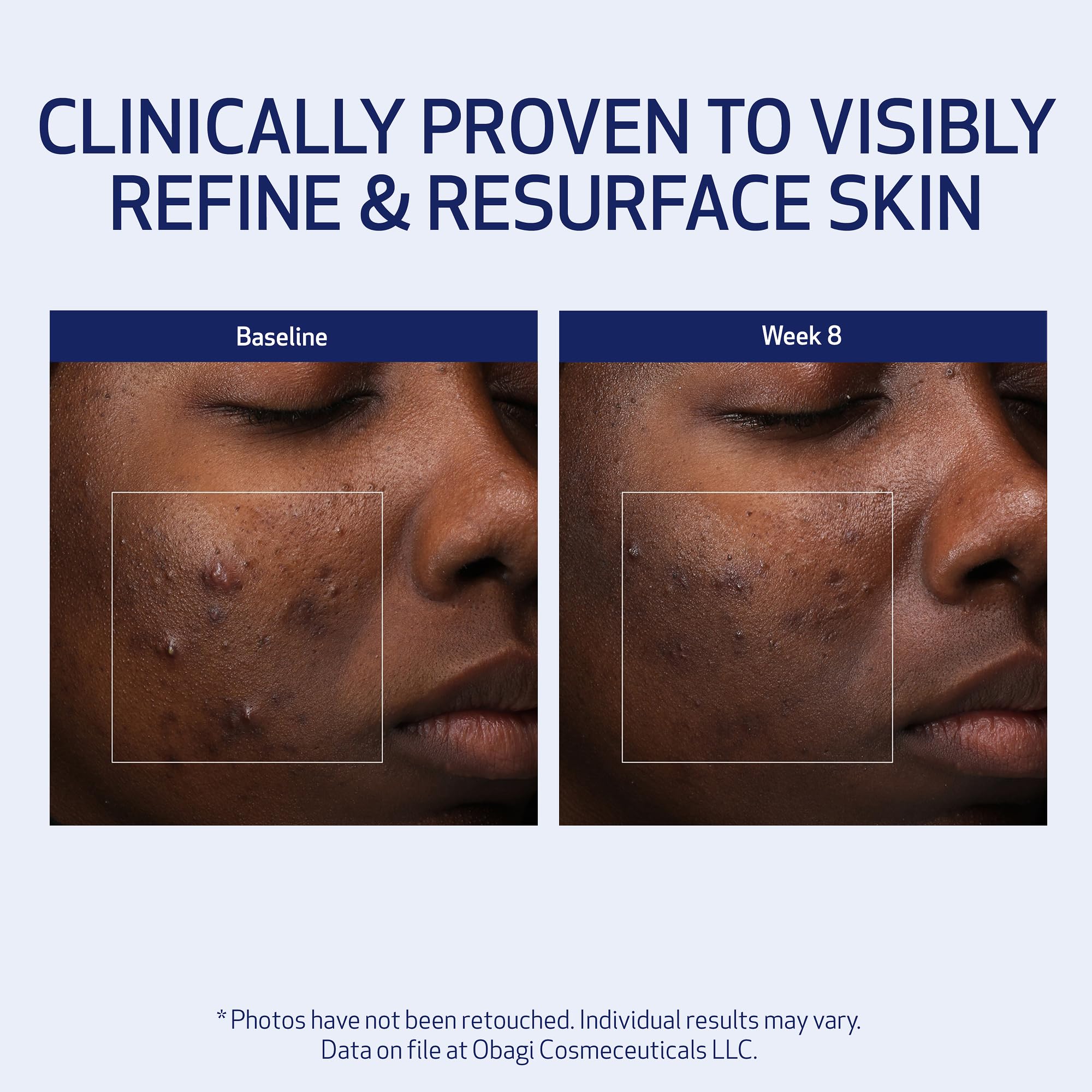 Obagi Medical Retinol + PHA Refining Night Cream, teint plus équilibré et lumineux au matin.