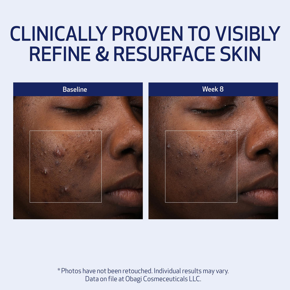 Obagi Medical Retinol + PHA Refining Night Cream, teint plus équilibré et lumineux au matin.