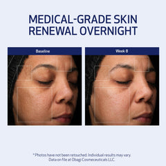 Obagi Medical Retinol + PHA Refining Night Cream, texture crème soyeuse prête à être appliquée.