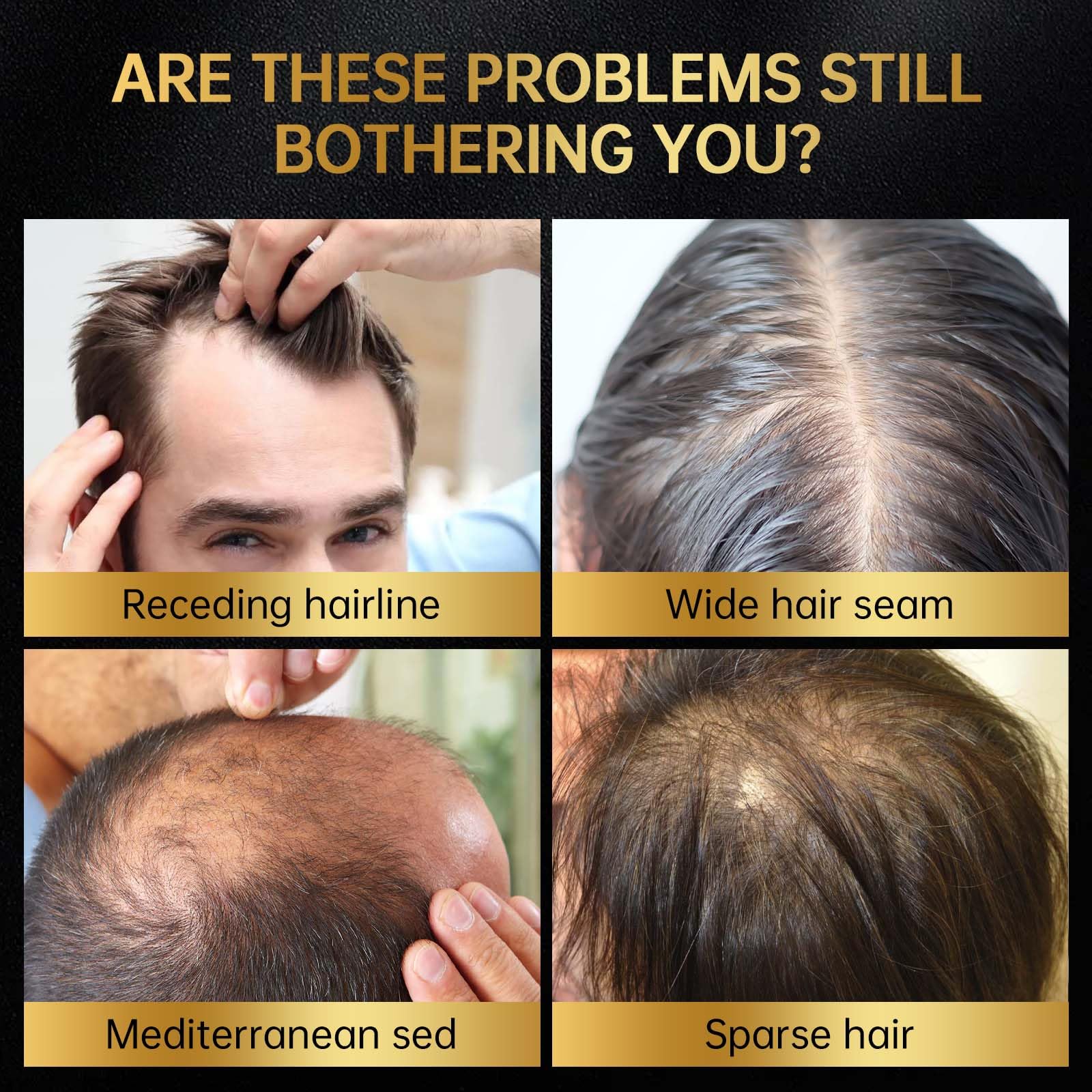 OCSINL Minoxidil goutteur pompe précis, dosage facilité des gouttes.