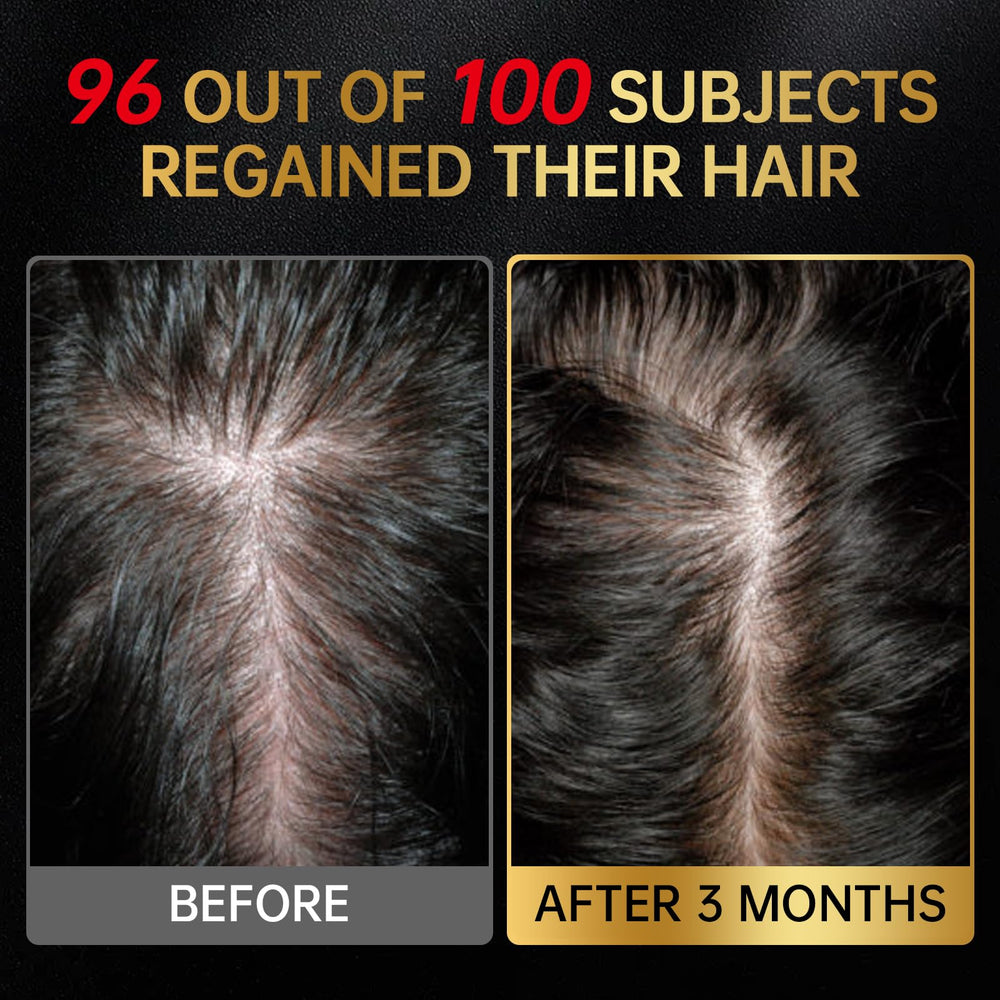 OCSINL Minoxidil ingrédients romarin, biotine et huile de batana, soin nourrissant.