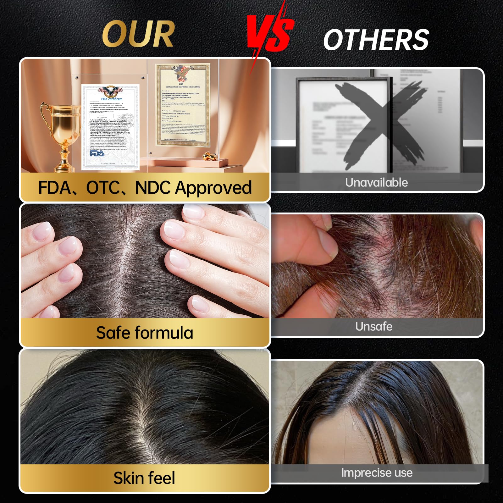 OCSINL Minoxidil kit voyage, pratique en déplacement.