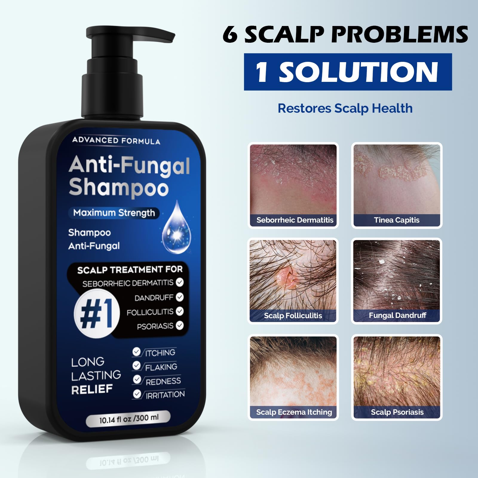 Shampoing Oely, application cuir chevelu illustrant soin ciblé.
