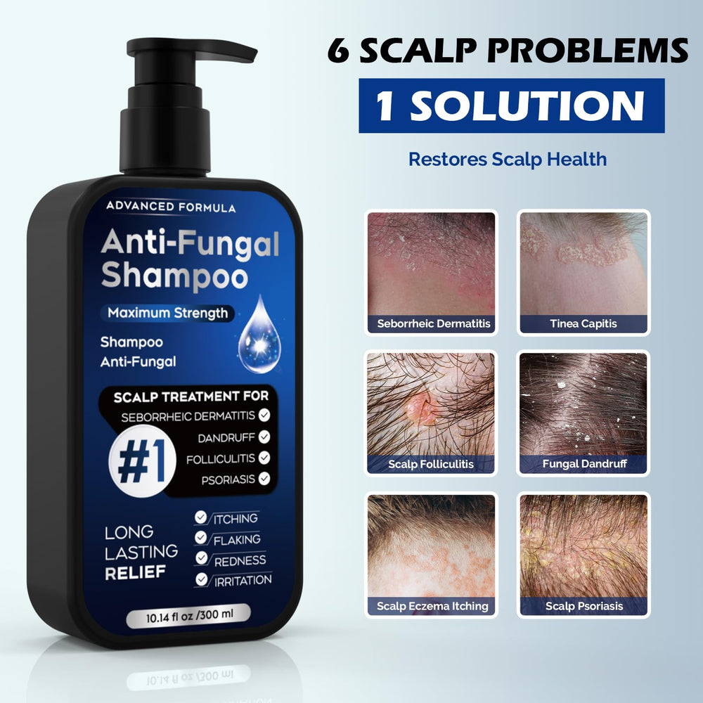 Shampoing Oely, application cuir chevelu illustrant soin ciblé.