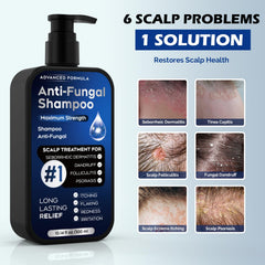 Shampoing Oely, application cuir chevelu illustrant soin ciblé.